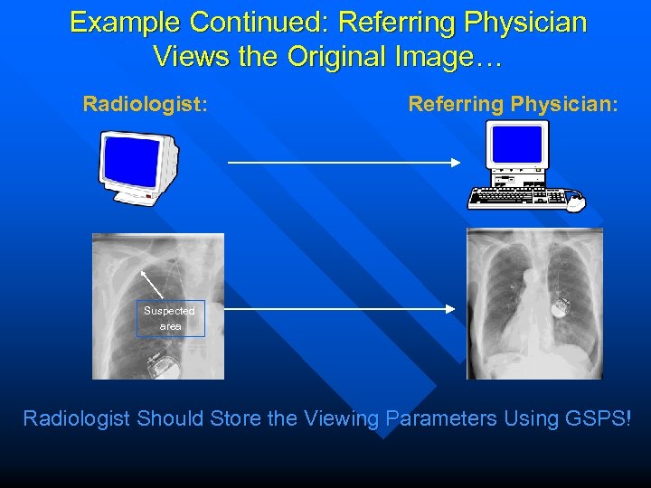 Example Continued: Referring Physician Views the Original Image… Radiologist: Referring Physician: Suspected area Radiologist