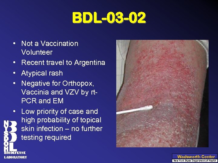 BDL-03 -02 • Not a Vaccination Volunteer • Recent travel to Argentina • Atypical