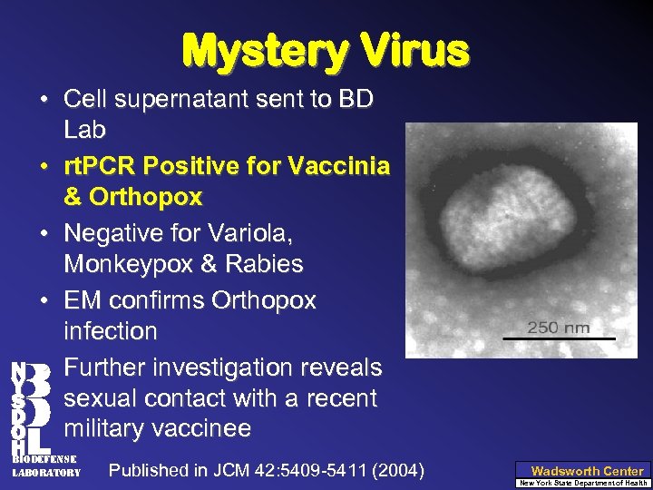 Mystery Virus • Cell supernatant sent to BD Lab • rt. PCR Positive for