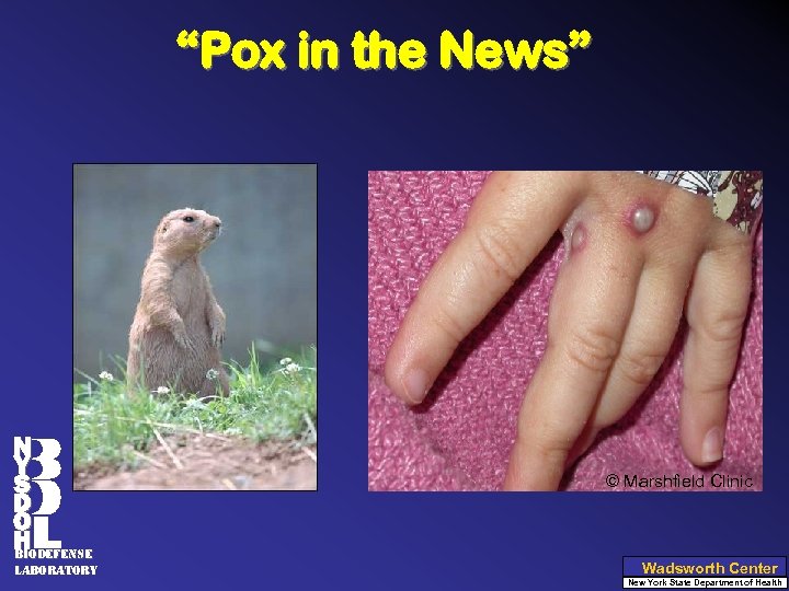 “Pox in the News” N Y S D O H biodefense Laboratory © Marshfield