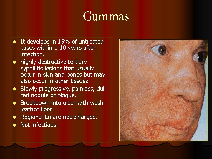 Gummas l l l It develops in 15% of untreated cases within 1 -10