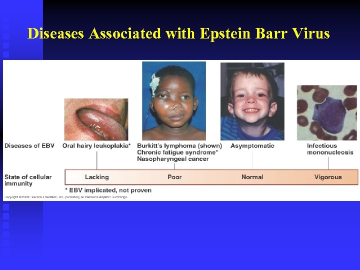 Diseases Associated with Epstein Barr Virus 