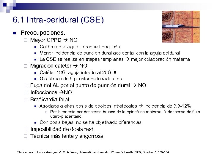6. 1 Intra-peridural (CSE) n Preocupaciones: ¨ Mayor CPPD NO n n n ¨