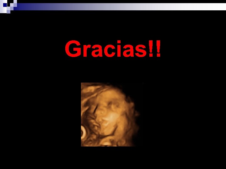 Gracias!! 