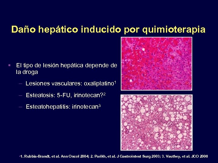 Daño hepático inducido por quimioterapia El tipo de lesión hepática depende de la droga