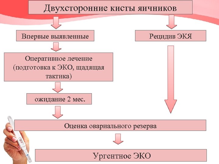 Двухсторонние кисты яичников Впервые выявленные Рецидив ЭКЯ Оперативное лечение (подготовка к ЭКО, щадящая тактика)