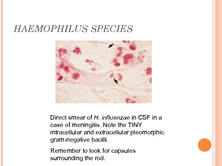 HAEMOPHILUS SPECIES Direct smear of H. influenzae in CSF in a case of meningitis.
