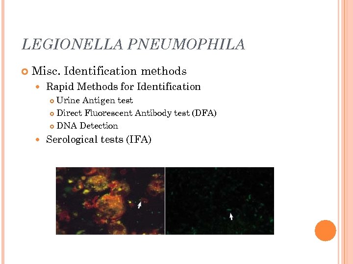 LEGIONELLA PNEUMOPHILA Misc. Identification methods Rapid Methods for Identification Urine Antigen test Direct Fluorescent