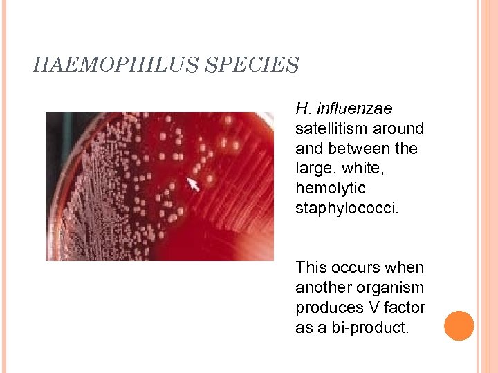 HAEMOPHILUS SPECIES H. influenzae satellitism around and between the large, white, hemolytic staphylococci. This