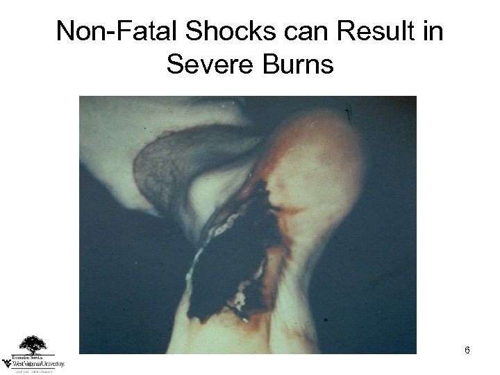 Non-Fatal Shocks can Result in Severe Burns 6 