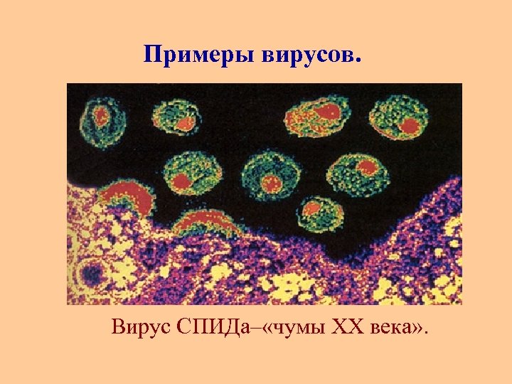 Примеры вирусов. Вирус СПИДа– «чумы XX века» . 