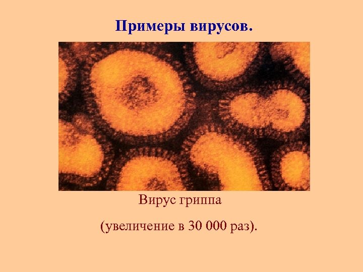 Примеры вирусов. Вирус гриппа (увеличение в 30 000 раз). 