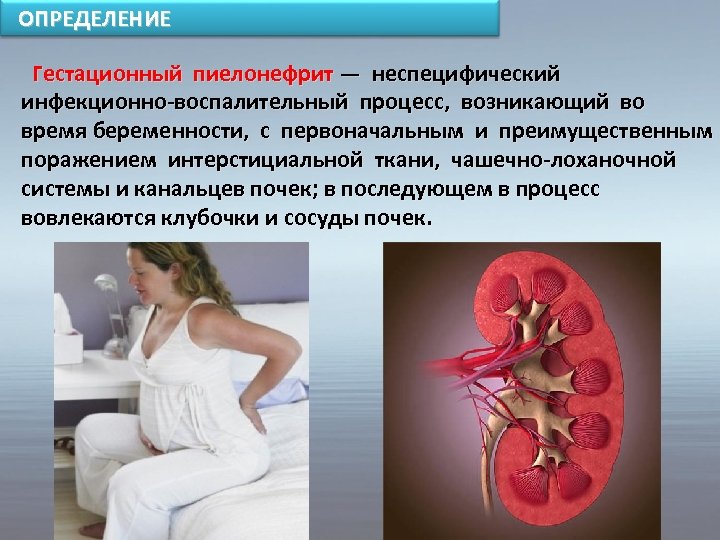 ОПРЕДЕЛЕНИЕ Гестационный пиелонефрит — неспецифический инфекционно-воспалительный процесс, возникающий во время беременности, с первоначальным и