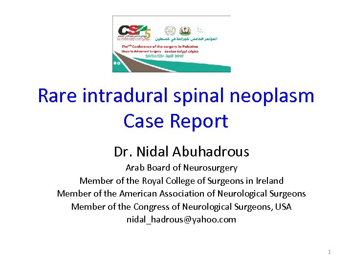 Rare intradural spinal neoplasm Case Report Dr. Nidal Abuhadrous Arab Board of Neurosurgery Member