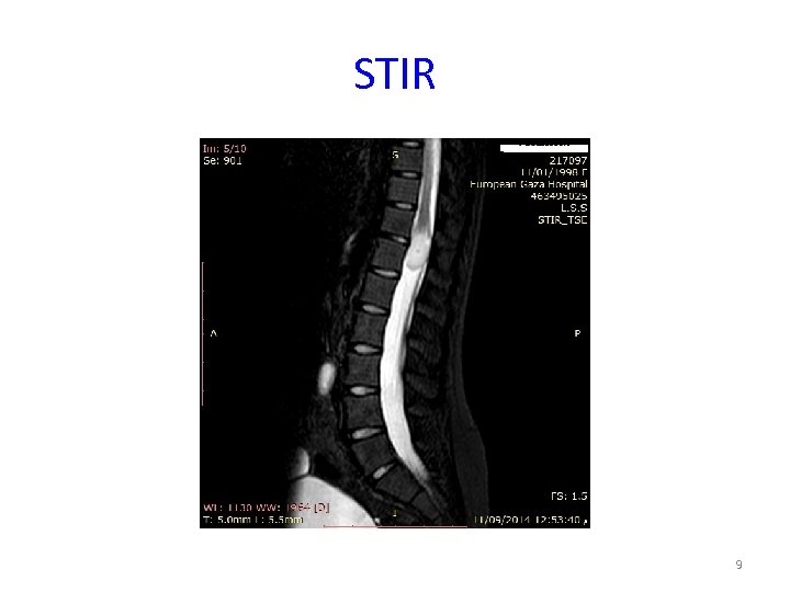STIR 9 