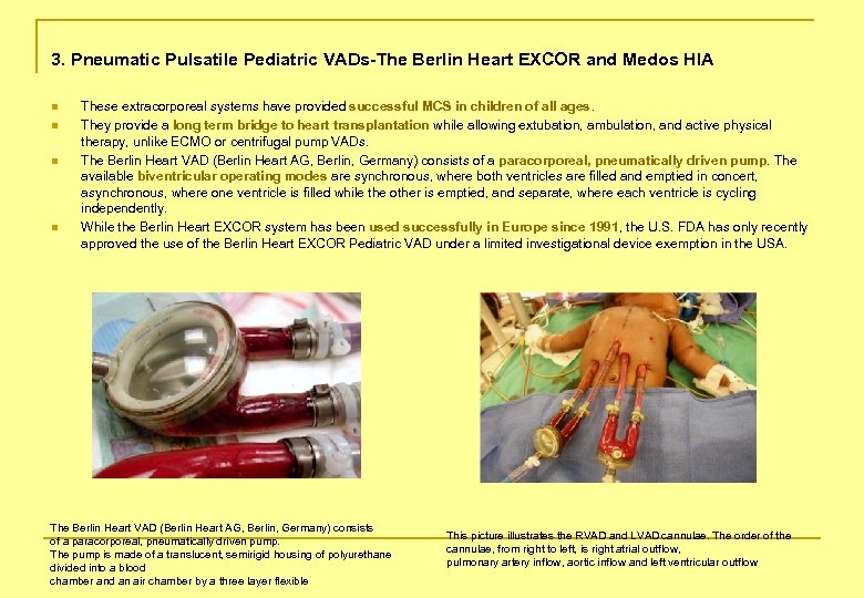 3. Pneumatic Pulsatile Pediatric VADs-The Berlin Heart EXCOR and Medos HIA n n These