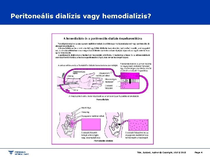 Peritoneális dialízis vagy hemodialízis? Title, Subject, Author © Copyright, 16/03/2018 Page 4 