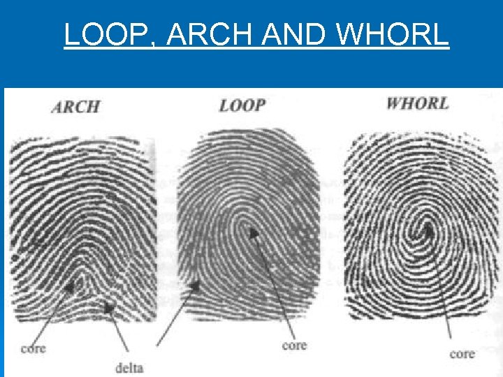 LOOP, ARCH AND WHORL 