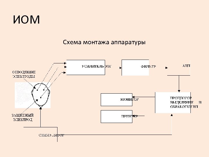 ИОМ Схема монтажа аппаратуры 