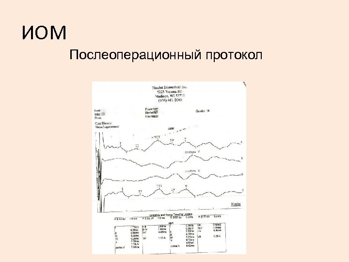 ИОМ Послеоперационный протокол 