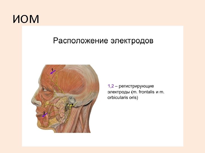 ИОМ 