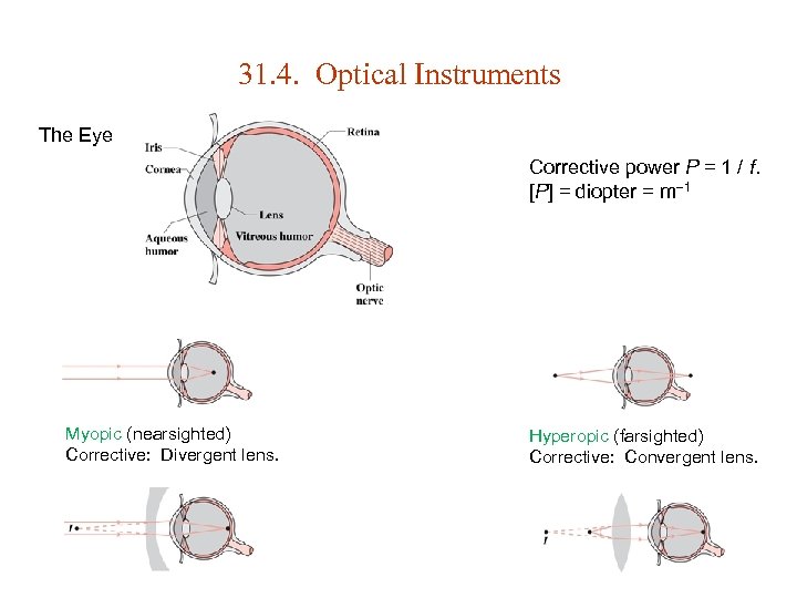 31. 4. Optical Instruments The Eye Corrective power P = 1 / f. [P]