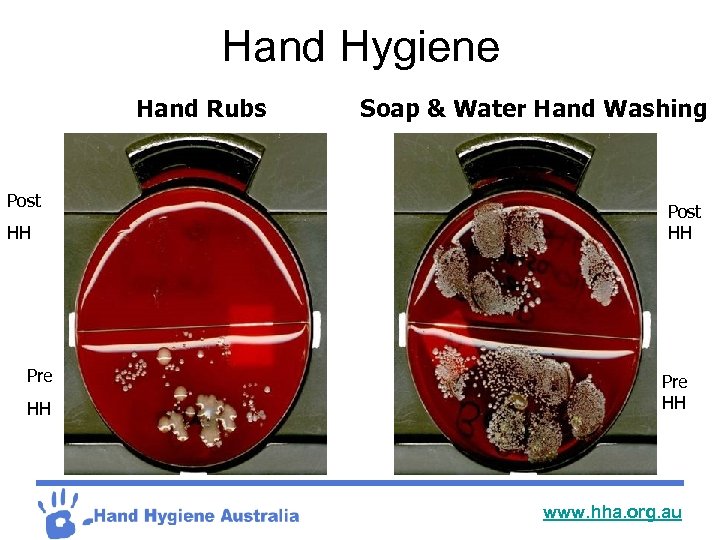 Hand Hygiene Hand Rubs Post HH Pre HH Soap & Water Hand Washing Post