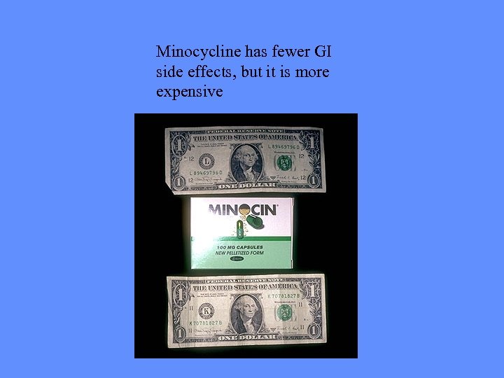 Minocycline has fewer GI side effects, but it is more expensive 