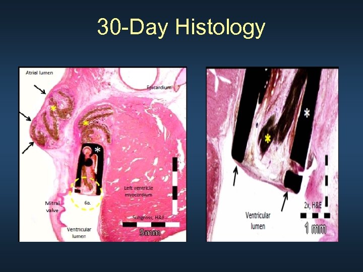 30 -Day Histology 