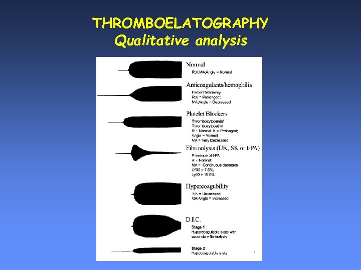 THROMBOELATOGRAPHY Qualitative analysis 