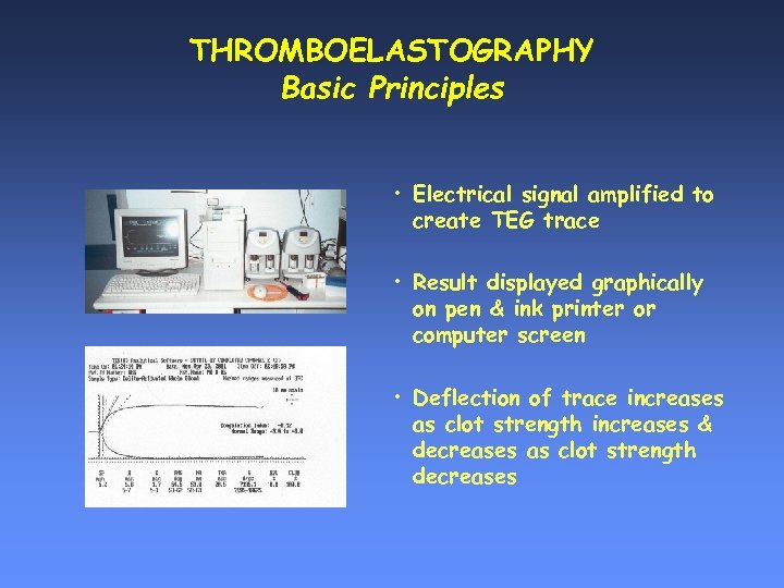 THROMBOELASTOGRAPHY Basic Principles • Electrical signal amplified to create TEG trace • Result displayed