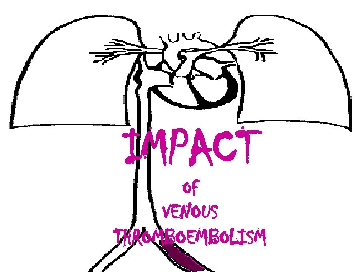 IMPACT OF VENOUS THROMBOEMBOLISM 