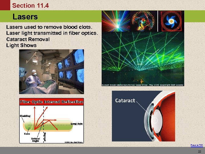 Section 11. 4 Lasers The Energy Levels of Hydrogen Lasers used to remove blood
