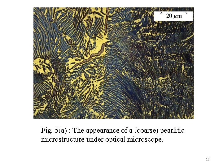 Fig. 5(a) : The appearance of a (coarse) pearlitic microstructure under optical microscope. 12