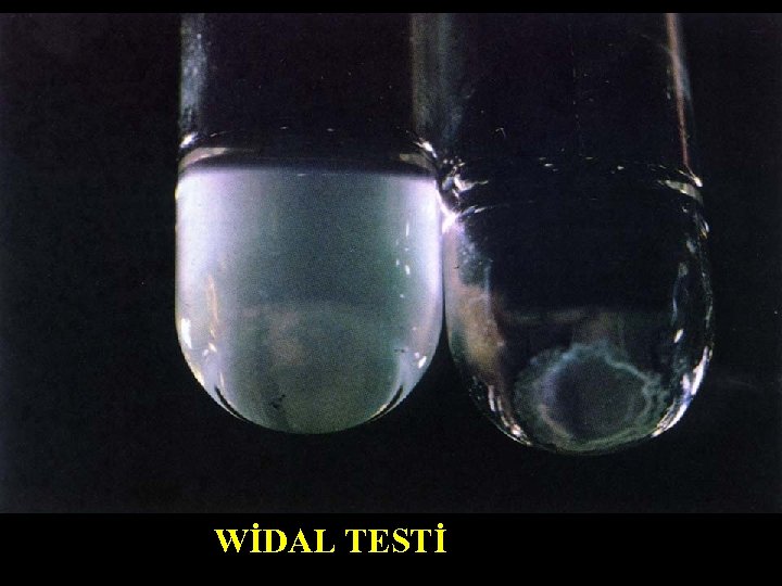 WİDAL TESTİ 