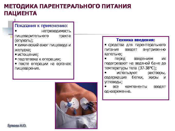 МЕТОДИКА ПАРЕНТЕРАЛЬНОГО ПИТАНИЯ ПАЦИЕНТА Показания к применению: • непроходимость пищеварительного тракта (опухоль); • химический