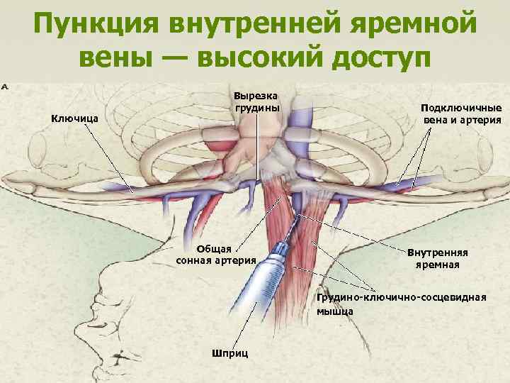 Клапаны яремной вены