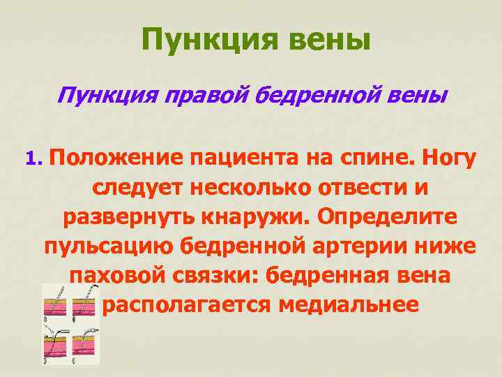 Пункция вены Пункция правой бедренной вены 1. Положение пациента на спине. Ногу следует несколько