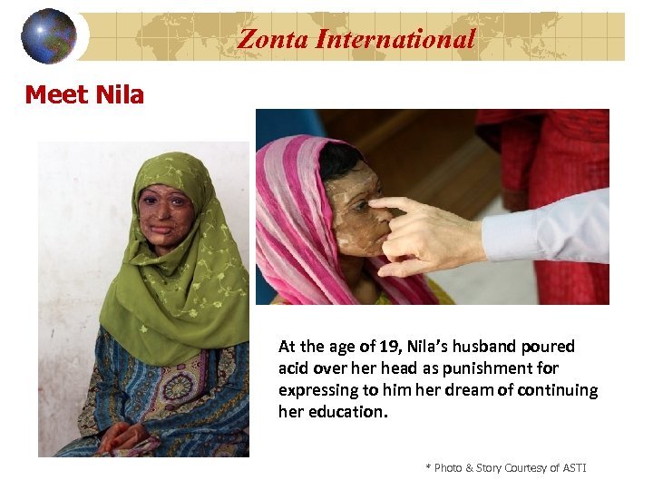 Zonta International Meet Nila At the age of 19, Nila’s husband poured acid over