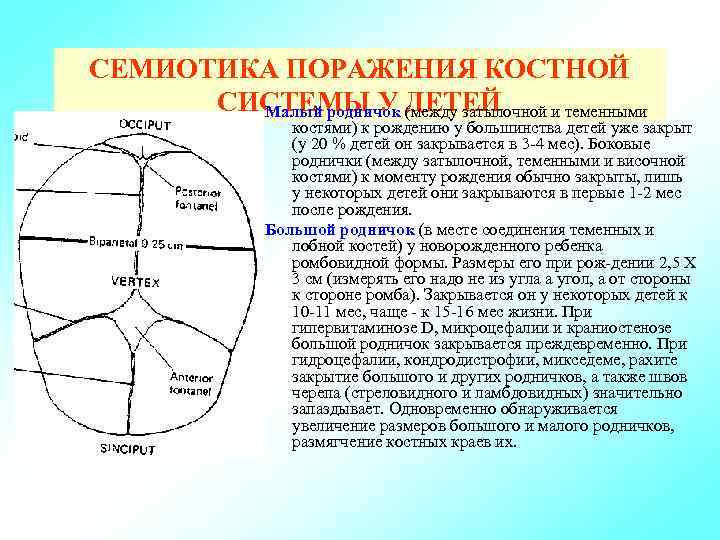 СЕМИОТИКА ПОРАЖЕНИЯ КОСТНОЙ СИСТЕМЫ У (между затылочной и теменными Малый родничок ДЕТЕЙ костями) к