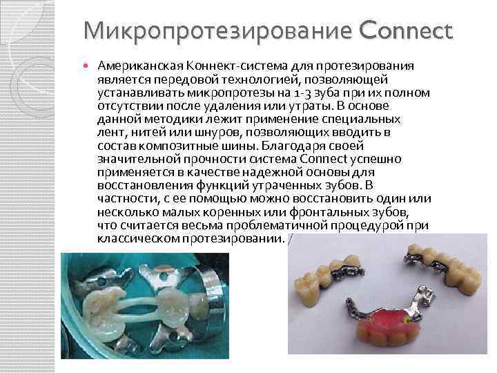 Микропротезирование Connect Американская Коннект-система для протезирования является передовой технологией, позволяющей устанавливать микропротезы на 1