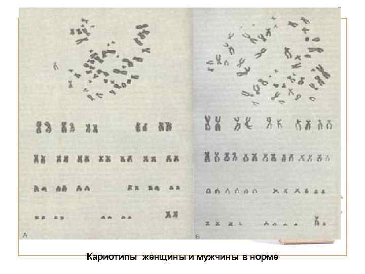 Кариотипы женщины и мужчины в норме 