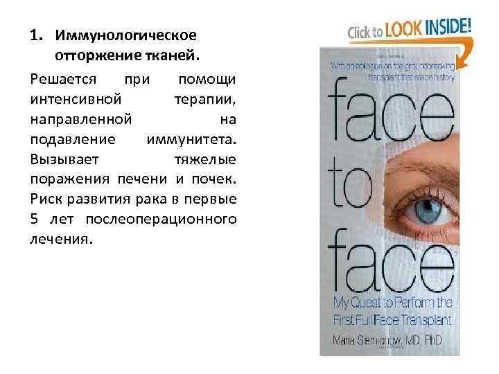 1. Иммунологическое отторжение тканей. Решается при помощи интенсивной терапии, направленной на подавление иммунитета. Вызывает