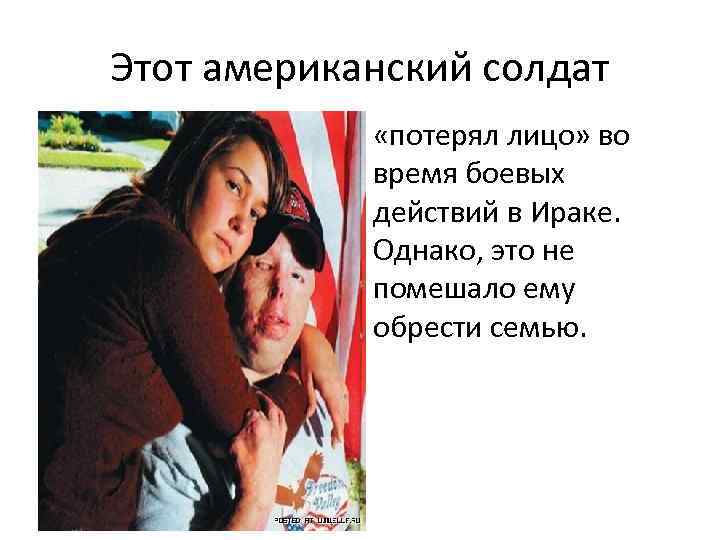 Этот американский солдат «потерял лицо» во время боевых действий в Ираке. Однако, это не