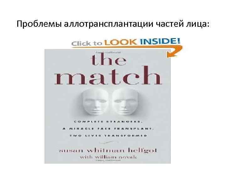 Проблемы аллотрансплантации частей лица: 