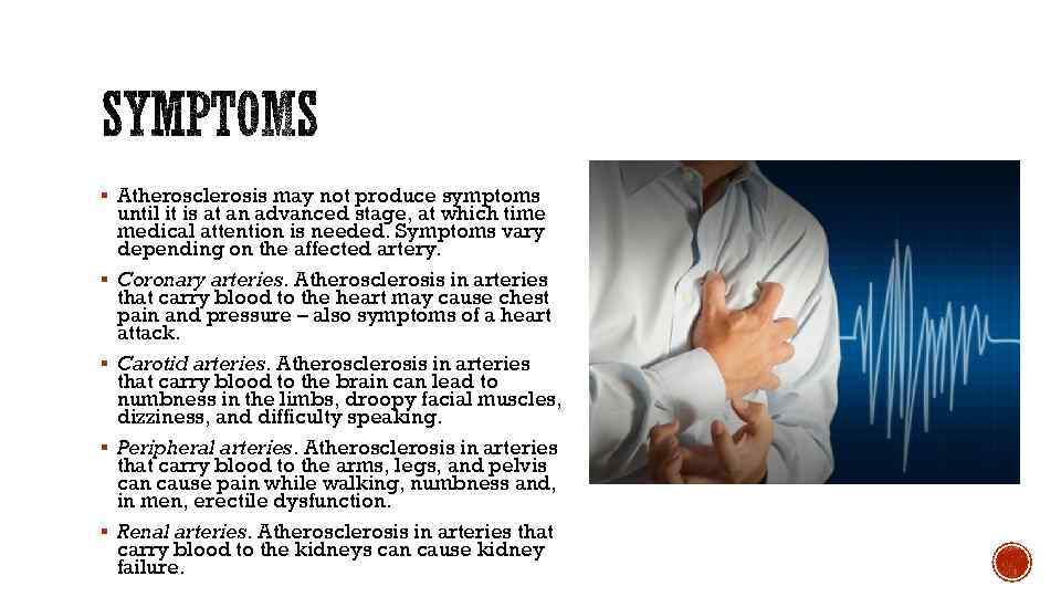 § Atherosclerosis may not produce symptoms § § until it is at an advanced