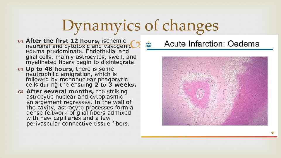 Dynamyics of changes After the first 12 hours, ischemic neuronal and cytotoxic and vasogenic