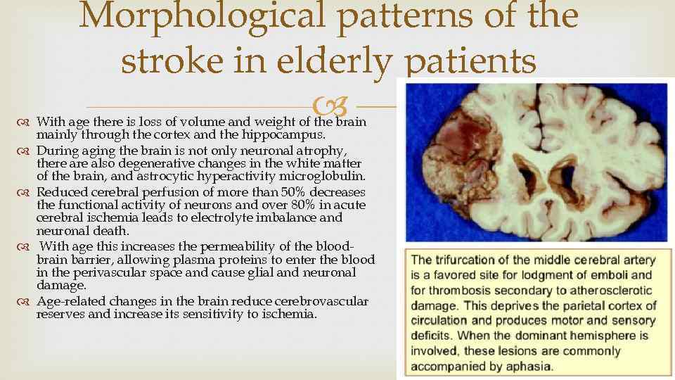 Morphological patterns of the stroke in elderly patients With age there is loss of