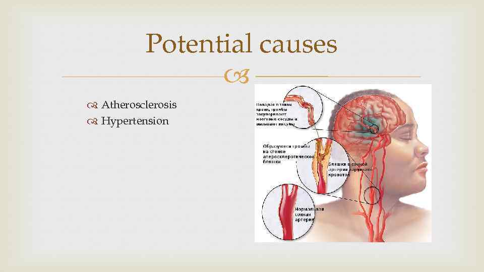 Potential causes Atherosclerosis Hypertension 