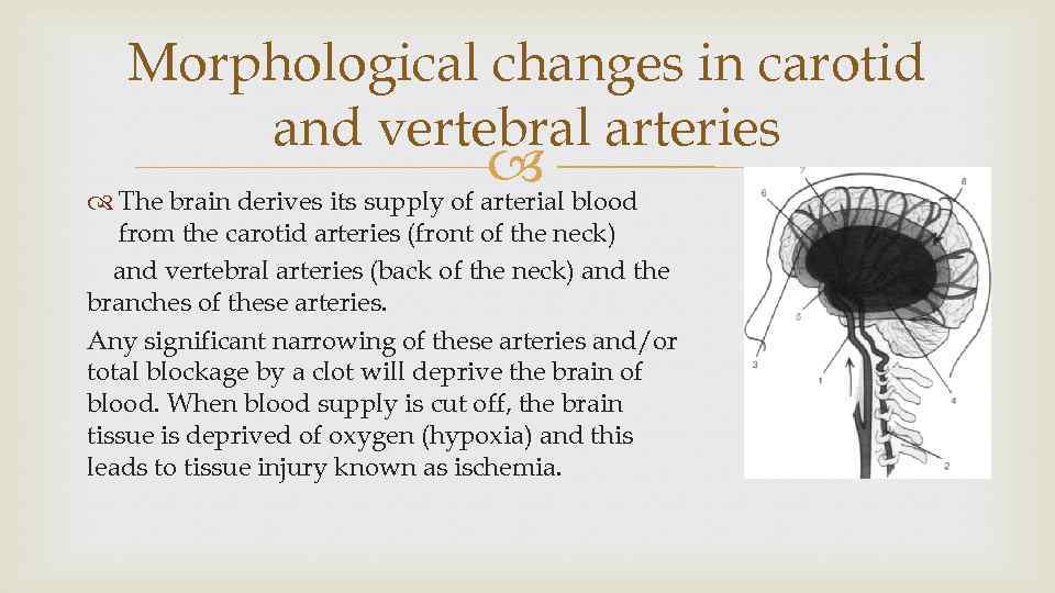 Morphological changes in carotid and vertebral arteries blood The brain derives its supply of